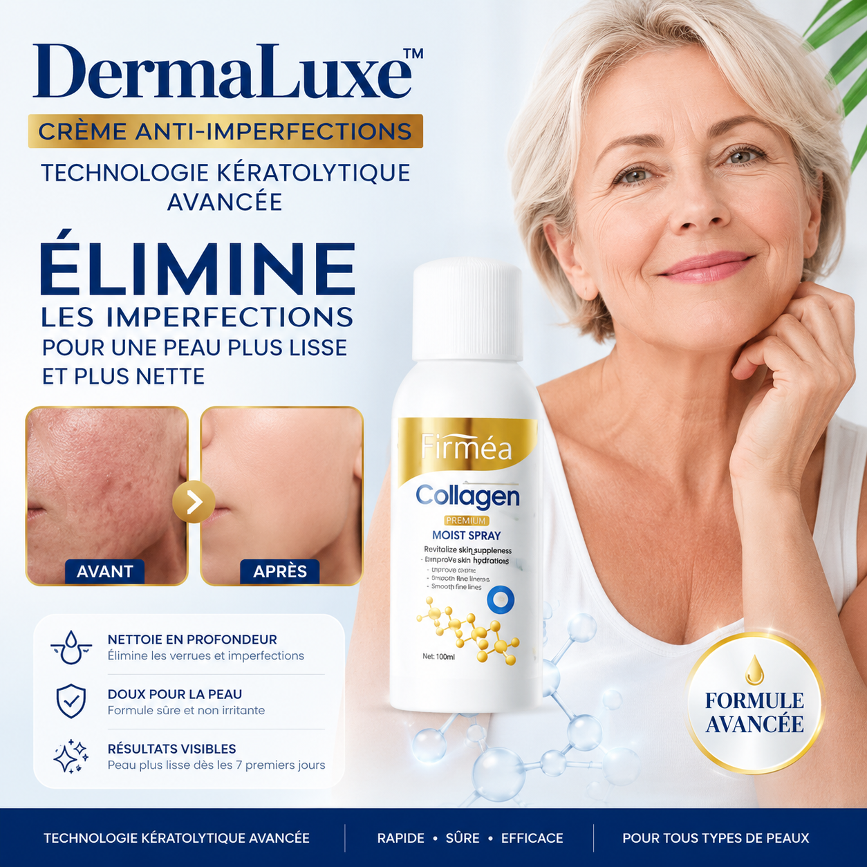 DermaLuxe™ Crème Anti-Imperfections | Technologie Kératolytique Avancée pour une Peau Plus Lisse et Plus Nette